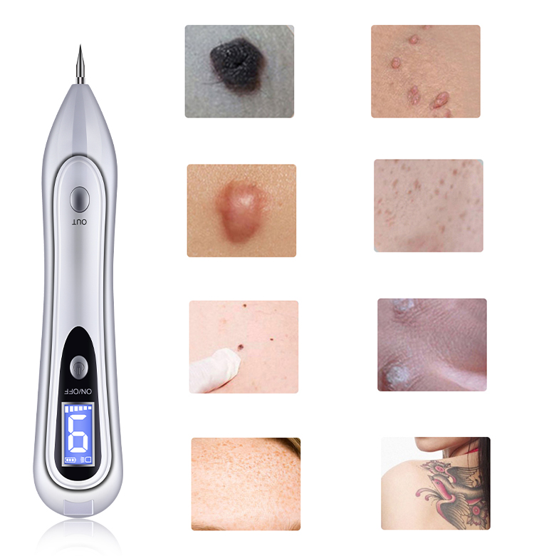 FY-B104 Pain-free mole removal pen - Image 4